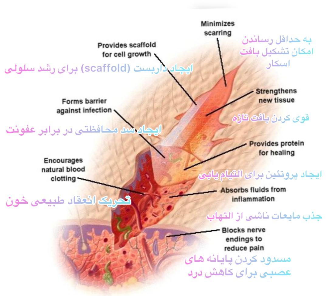 کیتوسان